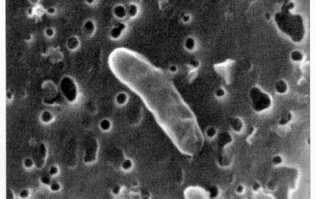 Scanning electron micrograph of bacteria from South Pole snow