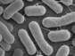 micrograph showing methane-eating bacteria