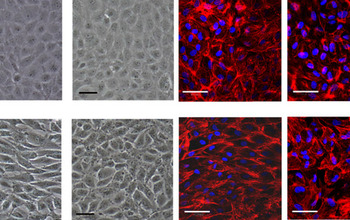 cells responding to stress from various blood flows