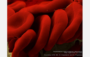 Erythrocytes (red blood cells)