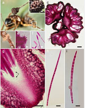 Distinguishing features of newly described species of parasitic fungus