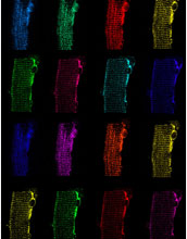 Series of images shows the distribution of a protein called CHC22 clathrin in human muscle cells