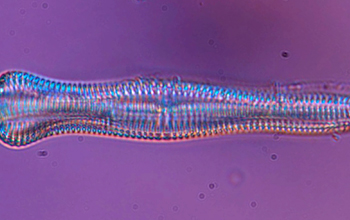 Diatom species <em>Gomphonema</em>