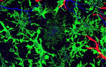 Image of glial cells in a mouse brain