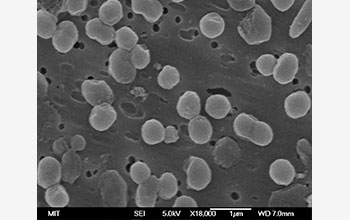 A scanning electron micrograph of the marine microbe <em>Prochlorococcus</em>