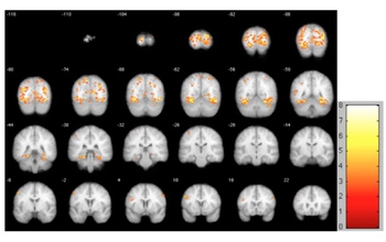 highlighted brain scans