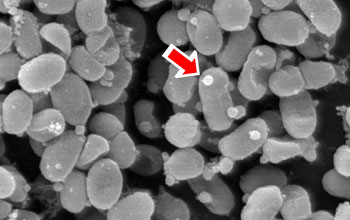 Scanning electron micrograph of the marine cyanobacterium, with arrow poitning to visible vesicles.