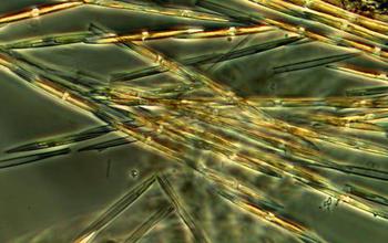 Dense cells of the harmful algae Pseudo-nitzchia during a bloom off the West Coast of North America.
