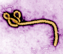 Ebola virus, as seen under a transmission electron microscope.