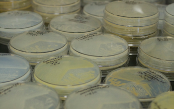 Photo of petri dishes containing bacteria harvested from amoebae.