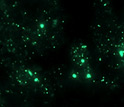 Photomicrograph of fluorescent microbes.