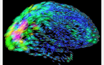 how abnormally active brain cells are turned off using multiple colors of light.