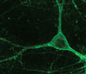 a mouse neuron taking on the characteristics of an Arch gene.