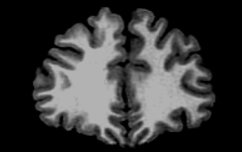 MRI scan of a 24 year-old male human brain.