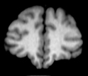 MRI scan of a 42 year-old male chimpanzee brain.