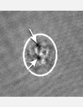 Computer graphic showing quantum vortices, which are responsible for stopping atomic motions.