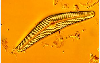 Diatom species <em>Cymbella cistula</em>