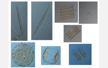 Micrographs of diatoms found near Antarctica.