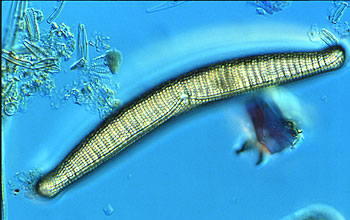 Diatom species <em>Epithemia</em>
