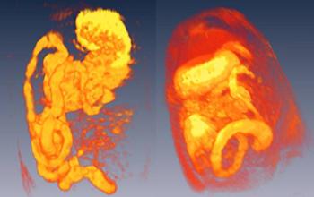 Three-dimensional reconstructions of magnetic resonance images of the rat gastro-intestinal tract.