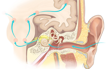This illustration shows how soundwaves interact with the human cochlea.