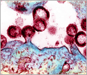 HIV virions budding and releasing from an infected cell.