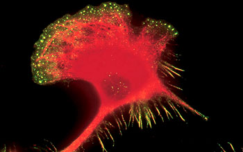 A macrophage (mobile cells) moves along a surface