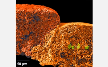 A SEM of fruiting body and thallus of lichen