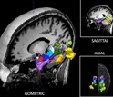 CT scan of human brain