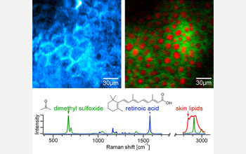 Figure showing SRS images for diffusion of retinoic acid and DMSO through skin.