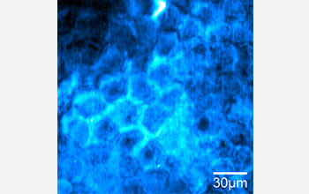 SRS image showing diffusion of retinoic acid