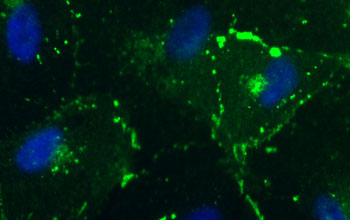 an image of primary human amniotic fluid stem cells in a culture dish