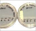 Antimicrobial responsive polymer surfaces