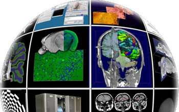 The Biomedical Informatics Research Network (BIRN)