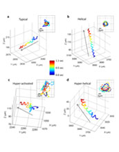 Images showing human male gamete cell swimming patterns.