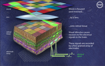 Illustration of the retinal readout system that allows recording of signals from hundreds of cells.