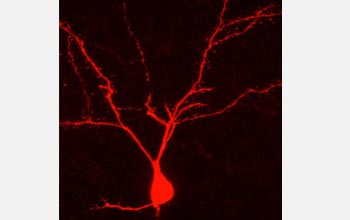 Photo of a rat neuron filled with an agent.