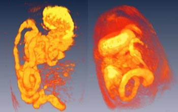 Three-dimensional reconstructions of magnetic resonance images of the rat gastrointestinal tract.