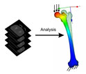 Stress analysis in a human femur performed directly from biomedical images.