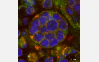 Developing T cells, or thymocytes, are engulfed within a "nurse" cell.