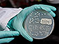 budding yeast colonies in a Petri dish