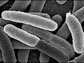 E. coli cells