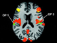 image showing regions of the brain