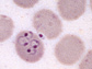 malaria parasite