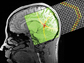 nonlinear acoustic waves