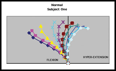 A diagram entitled, 'Normal Subject One.'