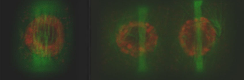 Cells undergoing mitosis