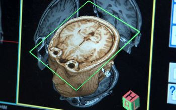 Mysteries of the Brain video series debuts- All Images
