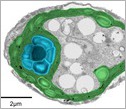 false-color electron microscopy image showing the pyrenoid of a green algea