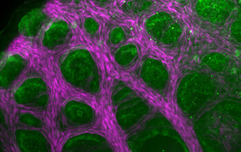 Detailed surface of a developing lizard lung